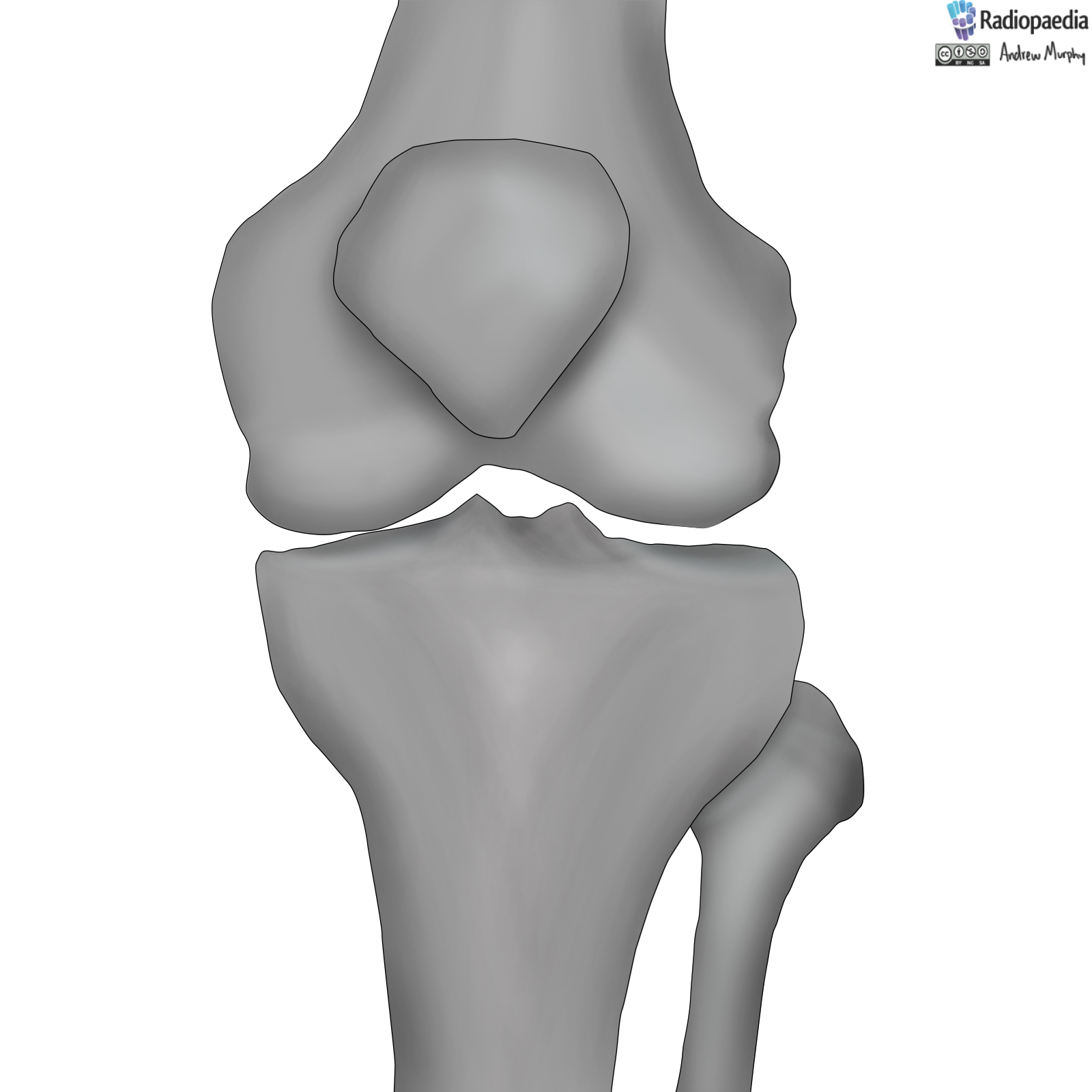 Radiopaedia Drawing Bones of the knee joint no labels AnatomyTOOL